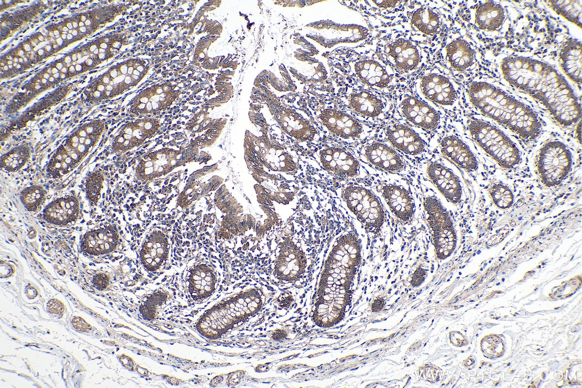 Immunohistochemical analysis of paraffin-embedded human colon tissue slide using KHC0128 (Cortactin IHC Kit).