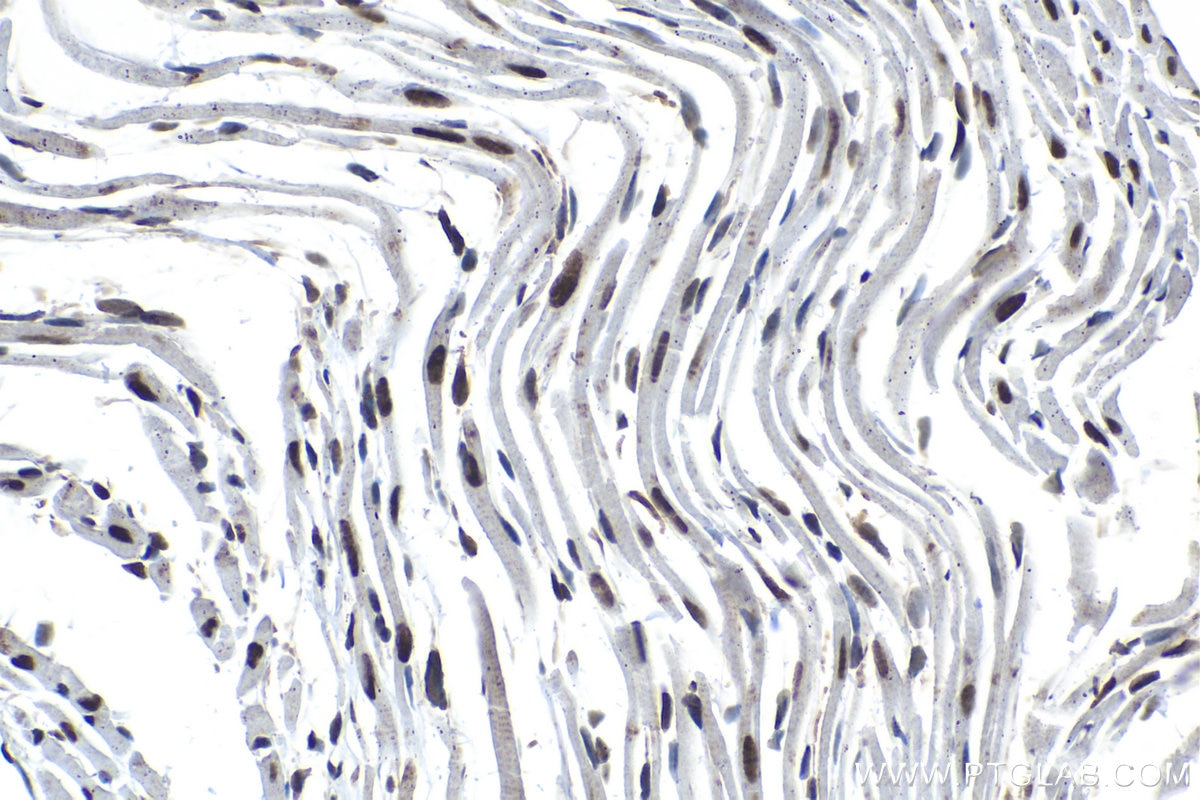 Immunohistochemical analysis of paraffin-embedded mouse heart tissue slide using KHC1562 (Cyclin C IHC Kit).
