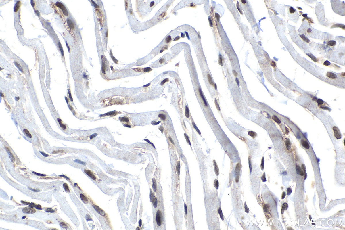 Immunohistochemical analysis of paraffin-embedded rat heart tissue slide using KHC1562 (Cyclin C IHC Kit).
