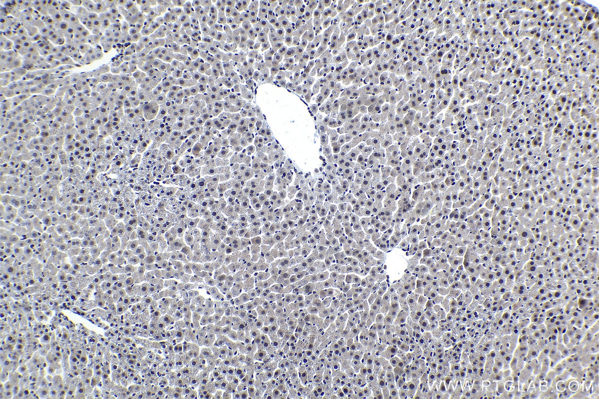 Immunohistochemical analysis of paraffin-embedded rat liver tissue slide using KHC1562 (Cyclin C IHC Kit).