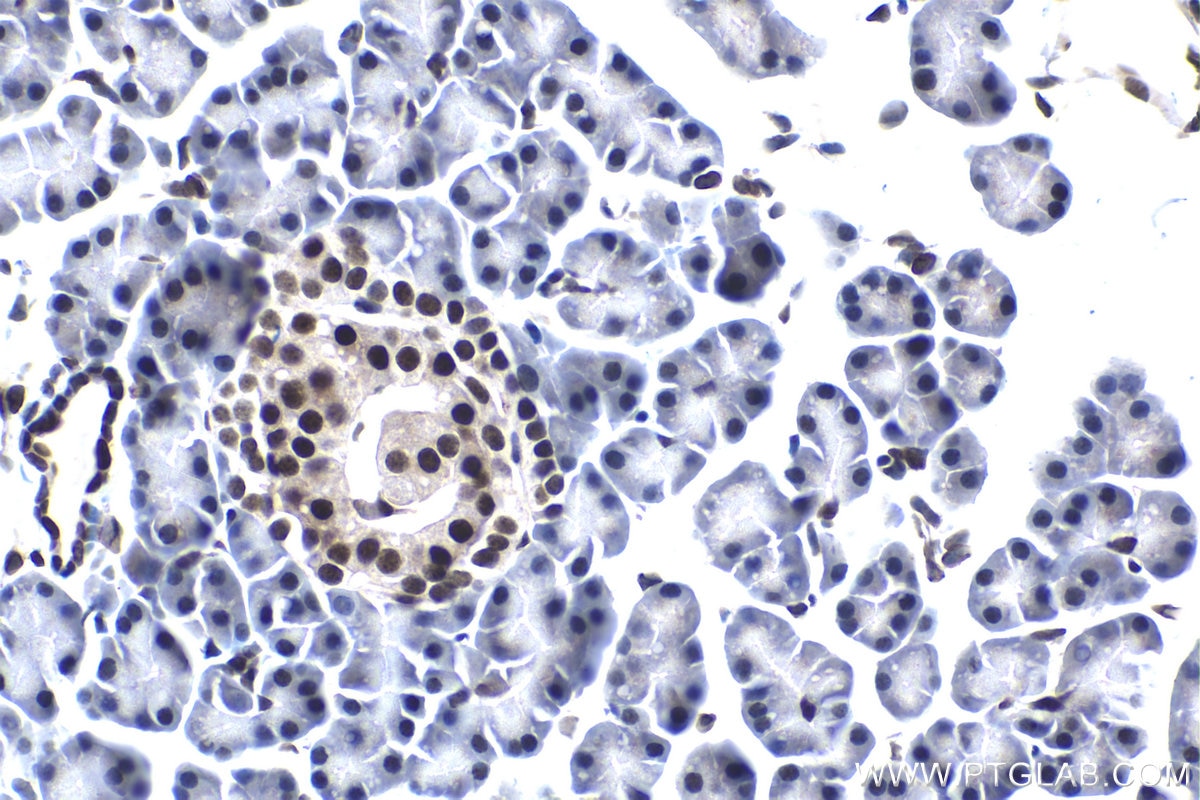 Immunohistochemical analysis of paraffin-embedded rat pancreas tissue slide using KHC1562 (Cyclin C IHC Kit).