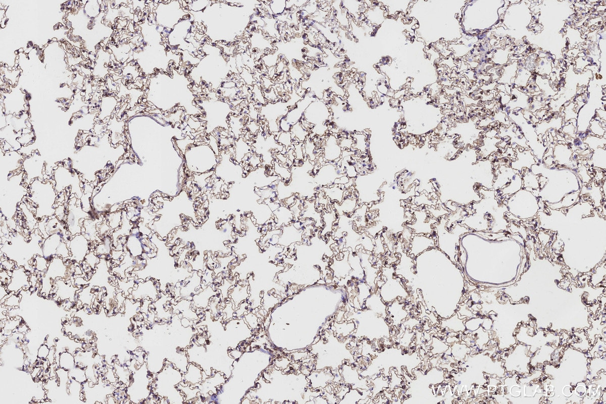 Immunohistochemical analysis of paraffin-embedded rat lung tissue slide using KHC3190 (Cytochrome P450 IHC Kit).