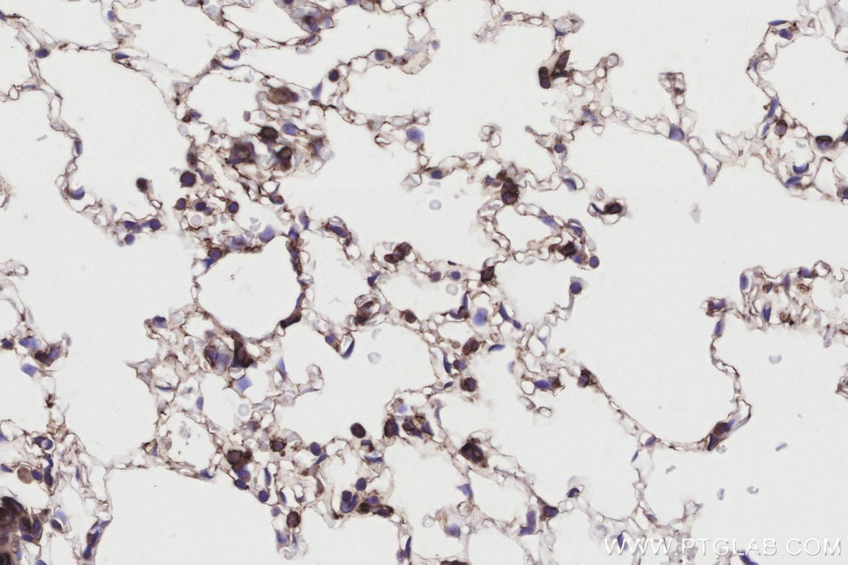 Immunohistochemical analysis of paraffin-embedded mouse lung tissue slide using KHC3190 (Cytochrome P450 IHC Kit).