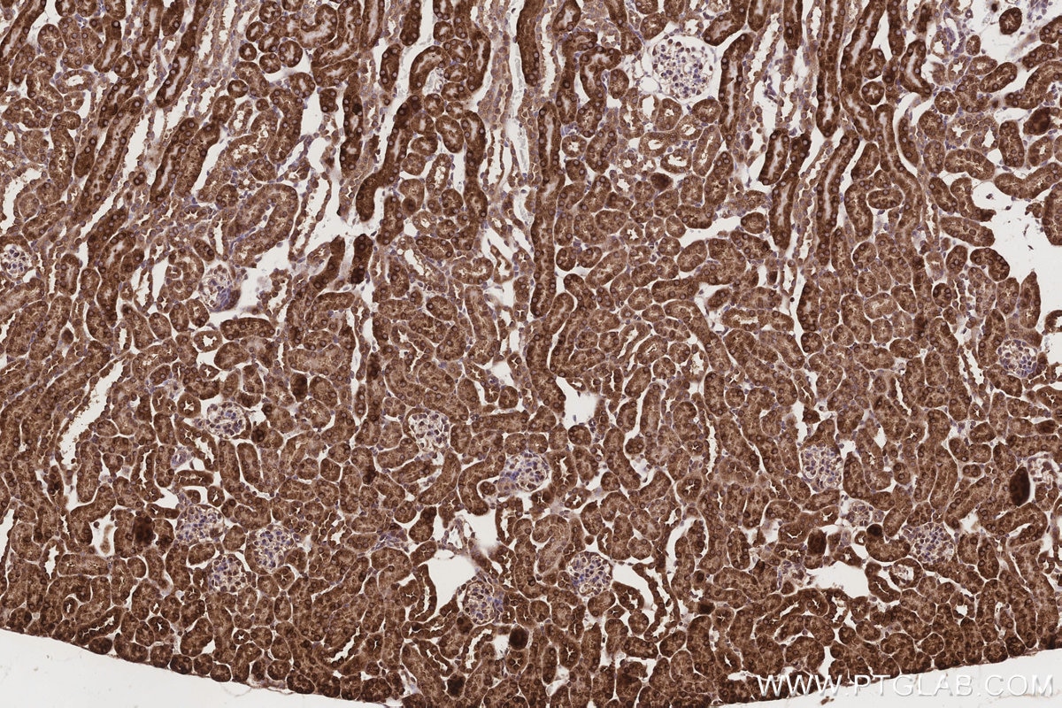 Immunohistochemical analysis of paraffin-embedded mouse kidney tissue slide using KHC3190 (Cytochrome P450 IHC Kit).
