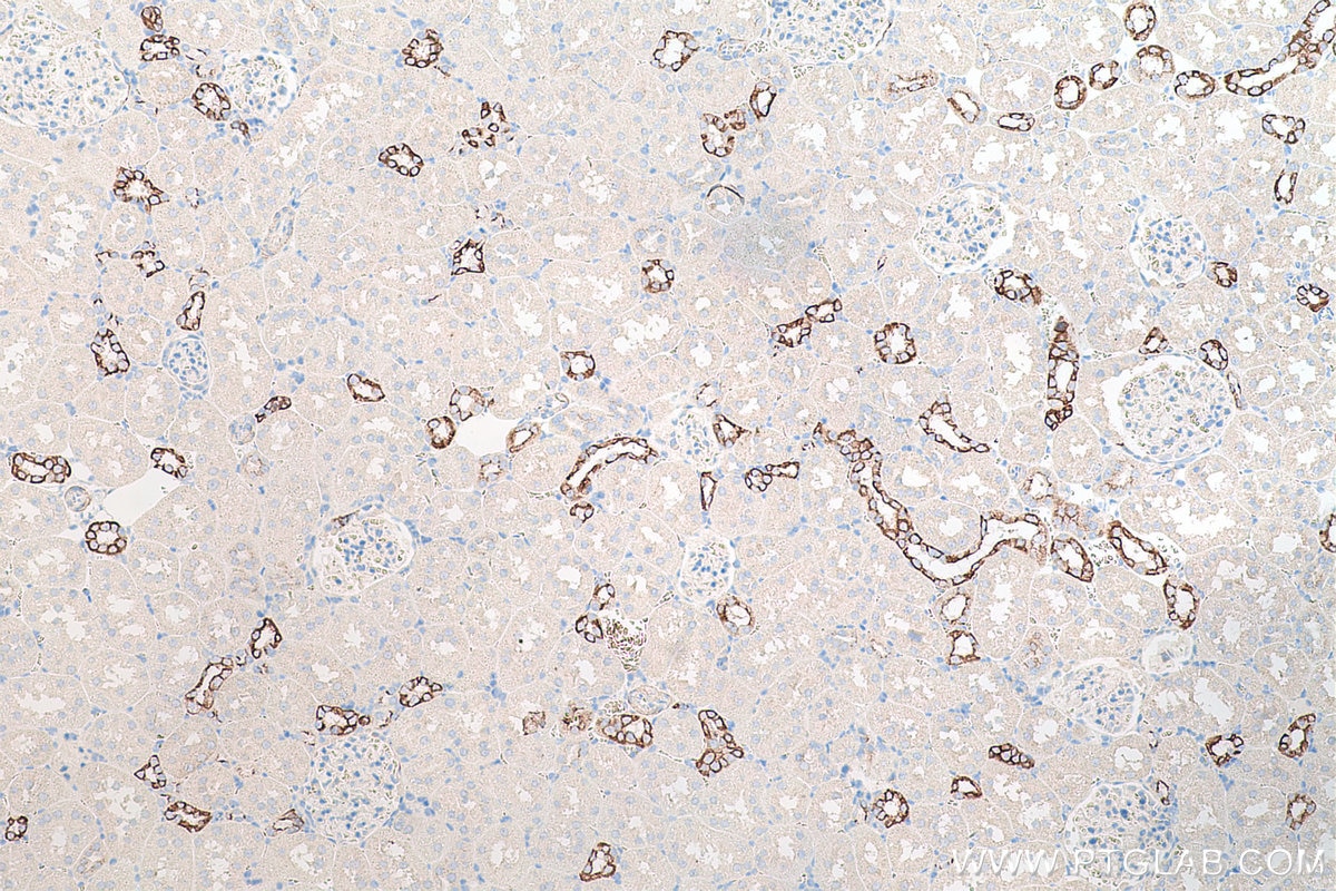 Immunohistochemical analysis of paraffin-embedded rat kidney tissue slide using KHC0204 (Cytokeratin 7 IHC Kit).