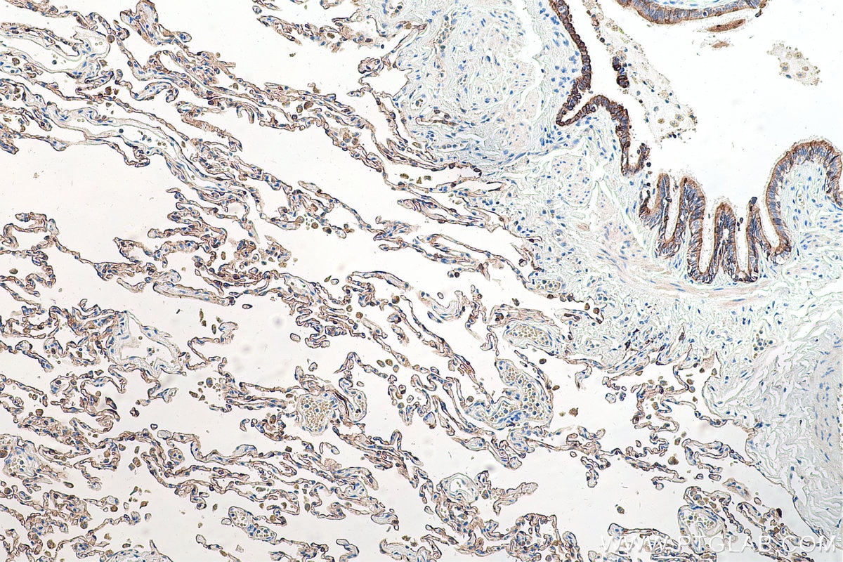 Immunohistochemical analysis of paraffin-embedded human lung tissue slide using KHC0204 (Cytokeratin 7 IHC Kit).