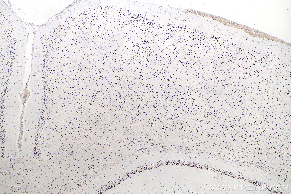 Immunohistochemical analysis of paraffin-embedded rat brain tissue slide using KHC0055 (DACH1 IHC Kit).