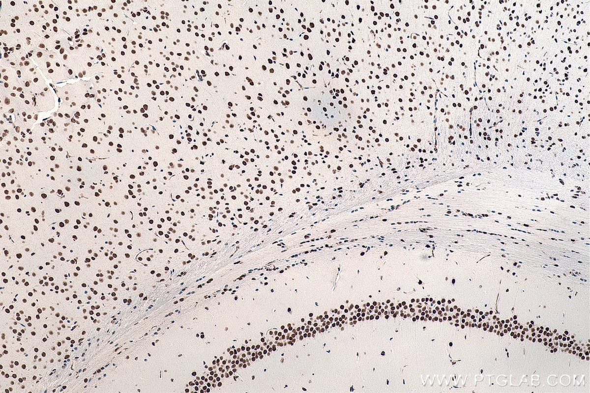 Immunohistochemical analysis of paraffin-embedded mouse brain tissue slide using KHC0055 (DACH1 IHC Kit).