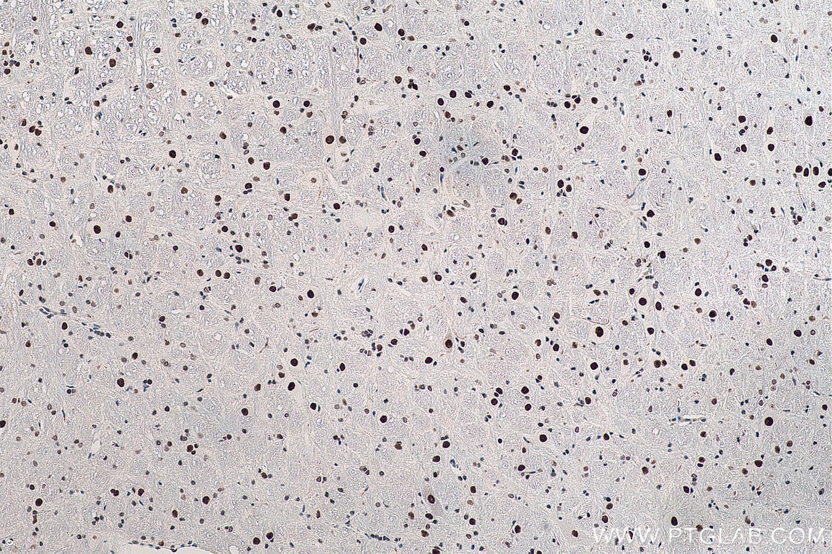 Immunohistochemical analysis of paraffin-embedded rat cerebellum tissue slide using KHC0055 (DACH1 IHC Kit).