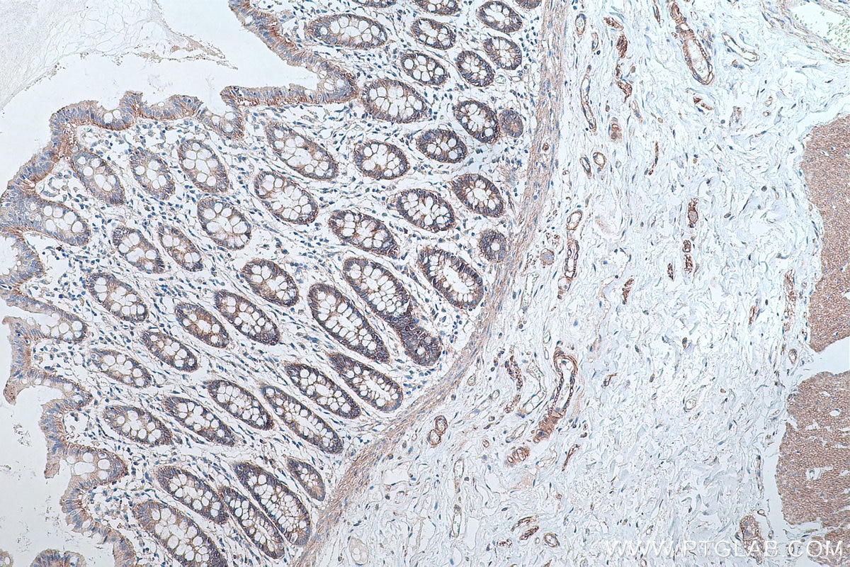 Immunohistochemical analysis of paraffin-embedded human colon tissue slide using KHC0285 (DAG1 IHC Kit).