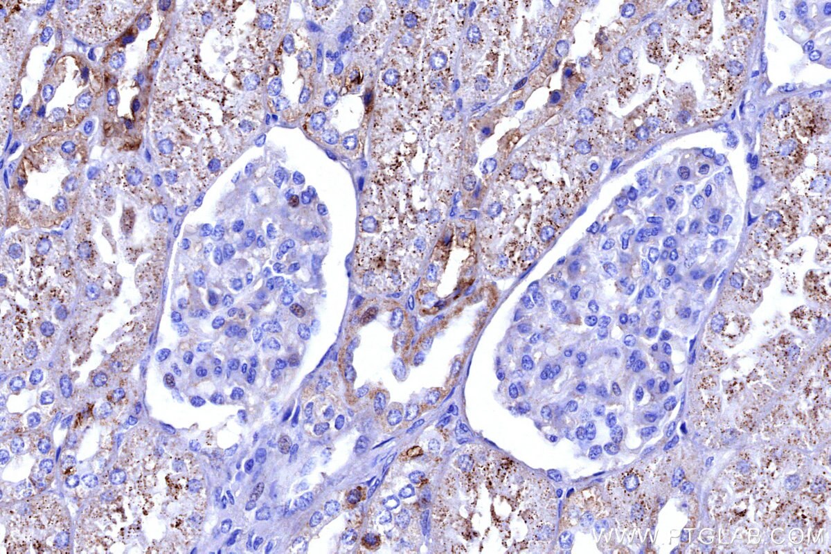 Immunohistochemical analysis of paraffin-embedded human kidney tissue slide using KHC3184 (DAO IHC Kit). Immunohistochemical analysis of paraffin-embedded human kidney tissue slide using KHC3184 (DAO IHC Kit).