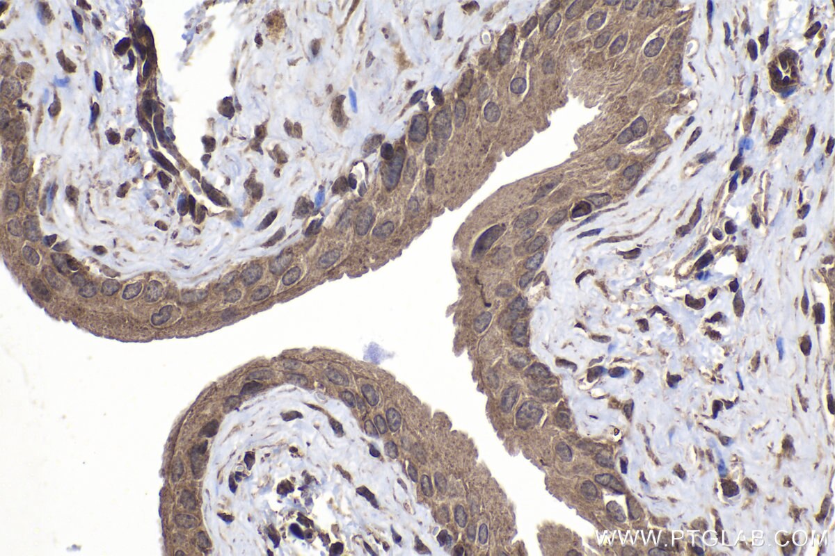 Immunohistochemical analysis of paraffin-embedded mouse bladder tissue slide using KHC1452 (DAPK3 IHC Kit).