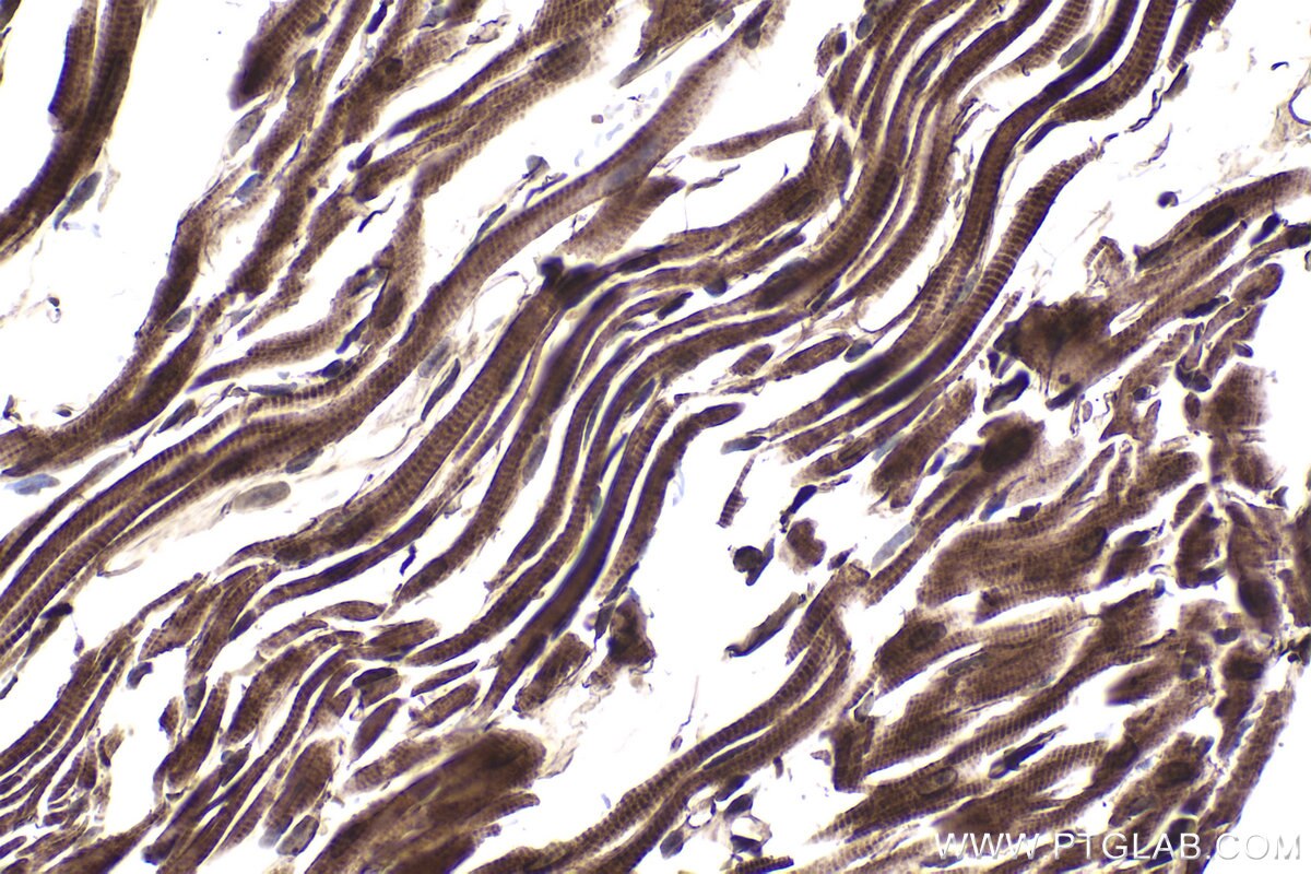 Immunohistochemical analysis of paraffin-embedded mouse heart tissue slide using KHC1452 (DAPK3 IHC Kit).