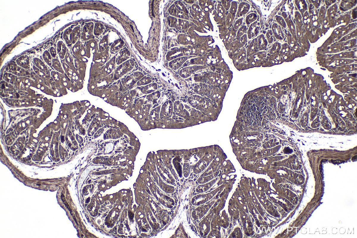 Immunohistochemical analysis of paraffin-embedded mouse colon tissue slide using KHC1452 (DAPK3 IHC Kit).