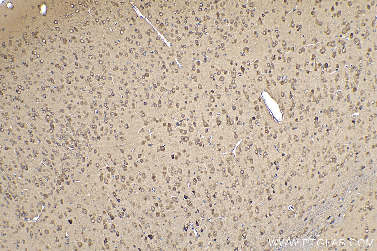 Immunohistochemical analysis of paraffin-embedded mouse brain tissue slide using KHC0843 (DARS IHC Kit).