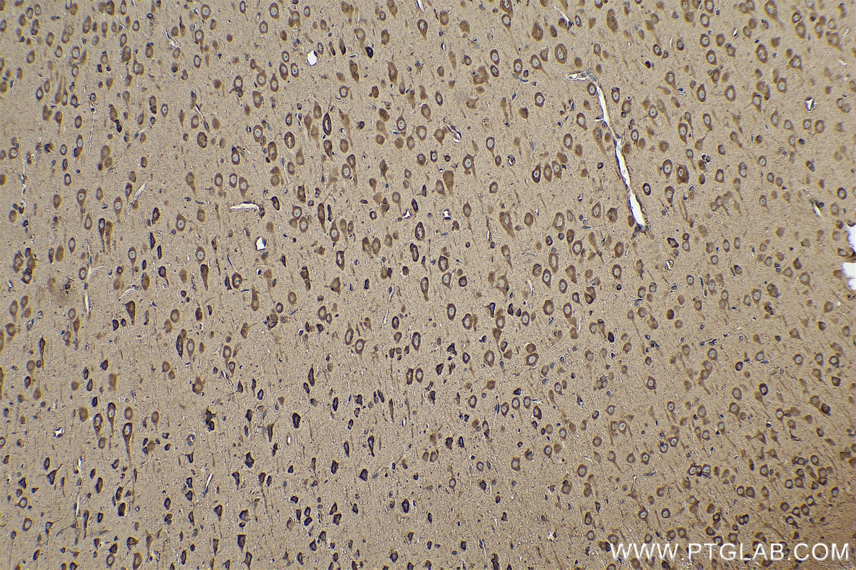 Immunohistochemical analysis of paraffin-embedded rat brain tissue slide using KHC0843 (DARS IHC Kit).