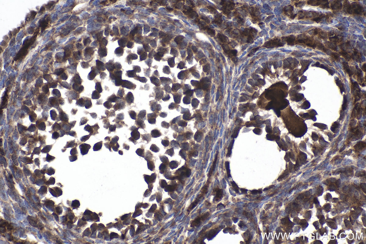 Immunohistochemical analysis of paraffin-embedded mouse ovary tissue slide using KHC1977 (DAXX IHC Kit).