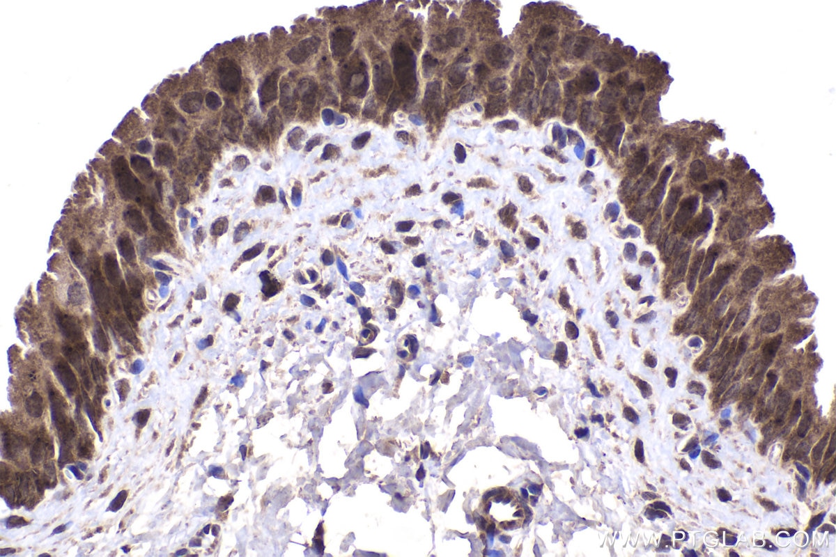 Immunohistochemical analysis of paraffin-embedded rat bladder tissue slide using KHC1977 (DAXX IHC Kit).