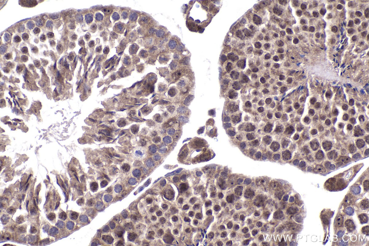 Immunohistochemical analysis of paraffin-embedded mouse testis tissue slide using KHC1977 (DAXX IHC Kit).