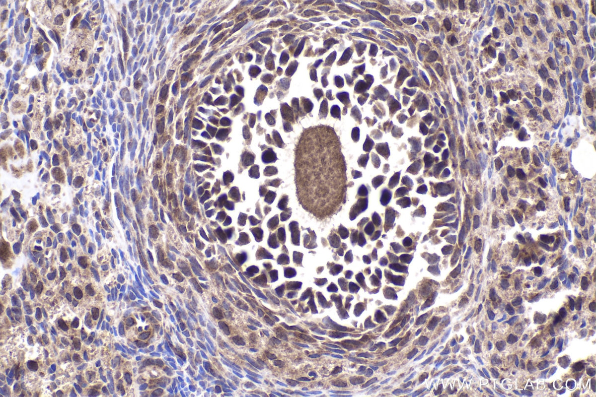 Immunohistochemical analysis of paraffin-embedded rat ovary tissue slide using KHC1977 (DAXX IHC Kit).