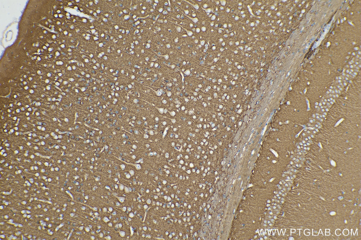 Immunohistochemical analysis of paraffin-embedded mouse brain tissue slide using KHC0848 (DBN1/Drebrin IHC Kit).