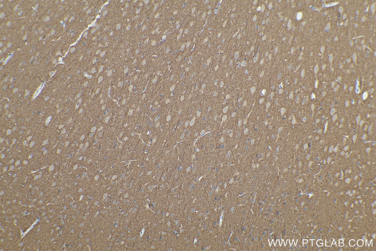 Immunohistochemical analysis of paraffin-embedded rat brain tissue slide using KHC0848 (DBN1/Drebrin IHC Kit).