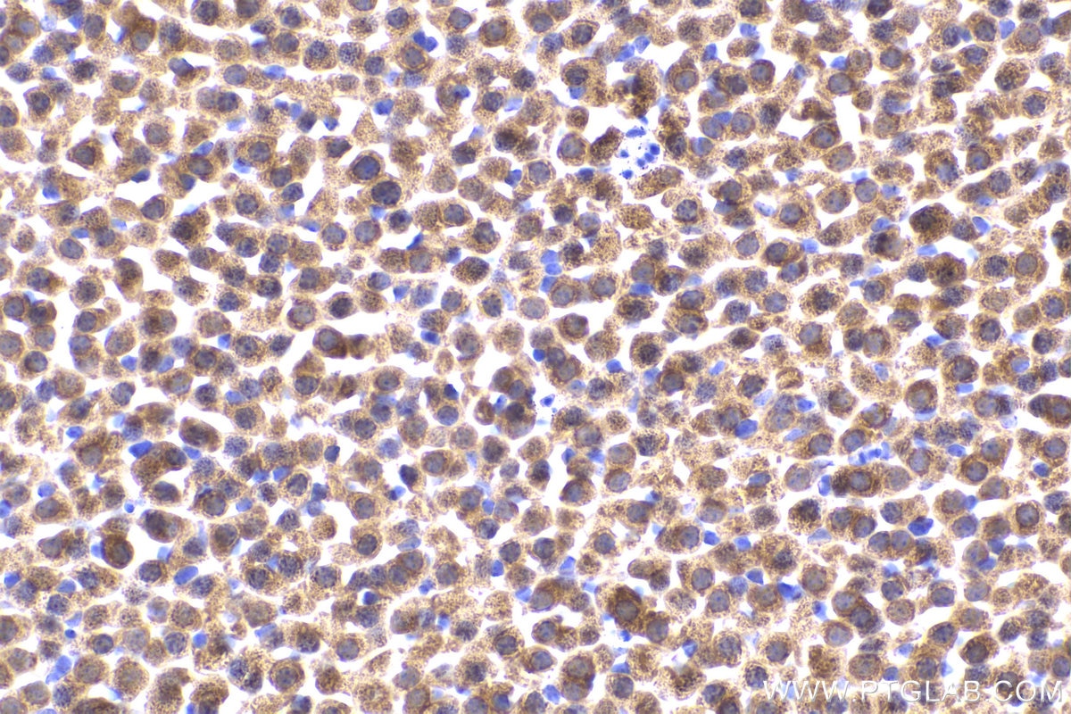 Immunohistochemical analysis of paraffin-embedded mouse adrenal gland tissue slide using KHC2179 (DBT IHC Kit).