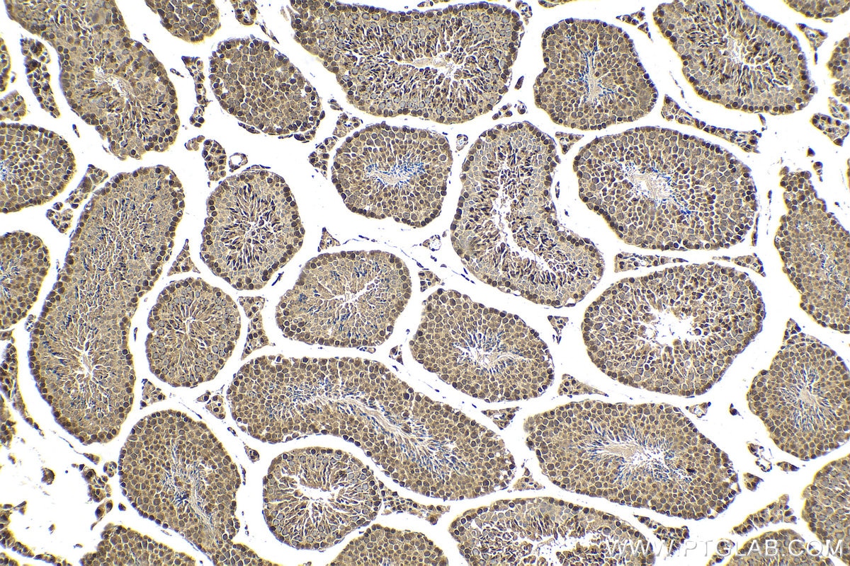 Immunohistochemical analysis of paraffin-embedded mouse testis tissue slide using KHC2022 (DCAF1/VPRBP IHC Kit).
