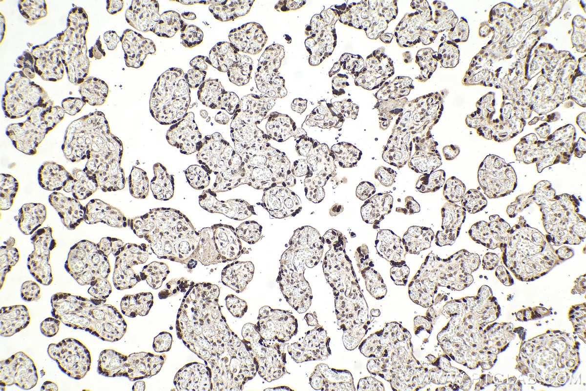 Immunohistochemical analysis of paraffin-embedded human placenta tissue slide using KHC2022 (DCAF1/VPRBP IHC Kit).