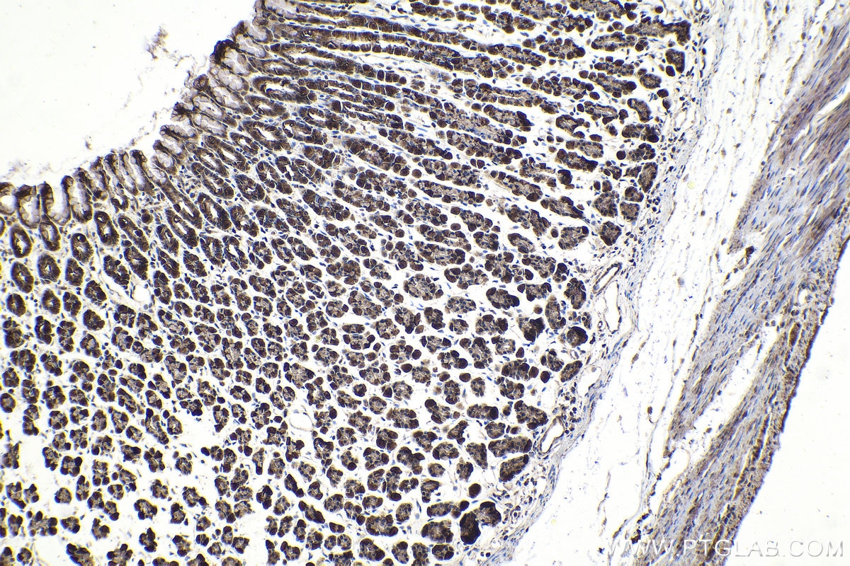 Immunohistochemical analysis of paraffin-embedded rat stomach tissue slide using KHC2022 (DCAF1/VPRBP IHC Kit).