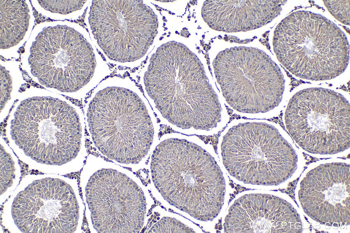 Immunohistochemical analysis of paraffin-embedded rat testis tissue slide using KHC1299 (DCAF12 IHC Kit).