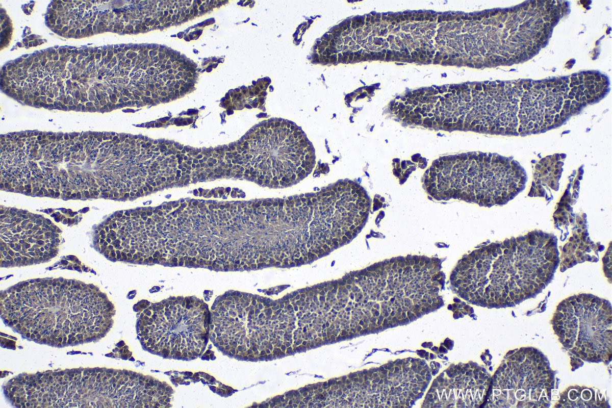 Immunohistochemical analysis of paraffin-embedded mouse testis tissue slide using KHC1299 (DCAF12 IHC Kit).