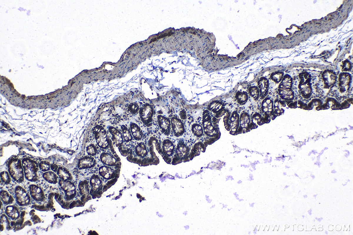 Immunohistochemical analysis of paraffin-embedded rat colon tissue slide using KHC1299 (DCAF12 IHC Kit).