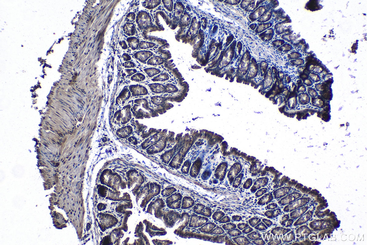 Immunohistochemical analysis of paraffin-embedded mouse colon tissue slide using KHC1299 (DCAF12 IHC Kit).