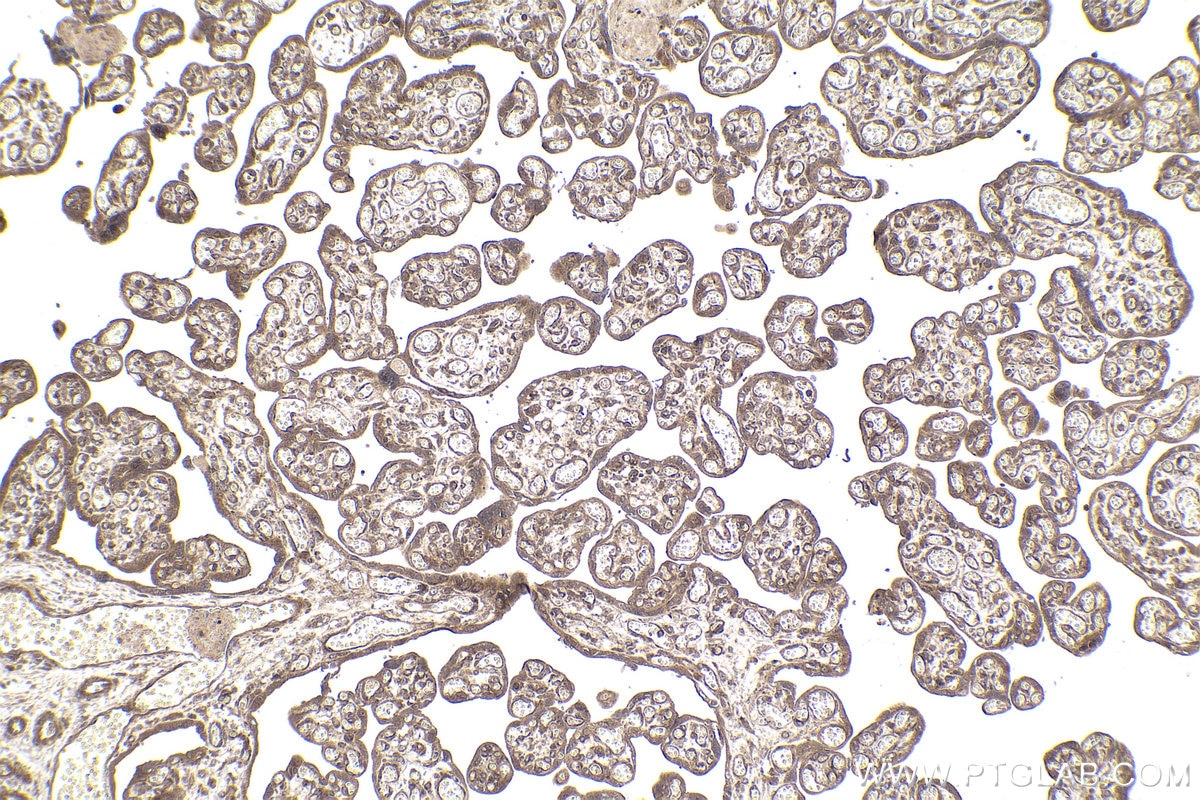 Immunohistochemical analysis of paraffin-embedded human placenta tissue slide using KHC1956 (DCP1A IHC Kit).