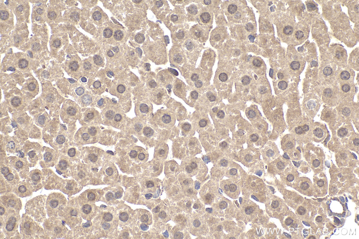 Immunohistochemical analysis of paraffin-embedded mouse liver tissue slide using KHC1956 (DCP1A IHC Kit).