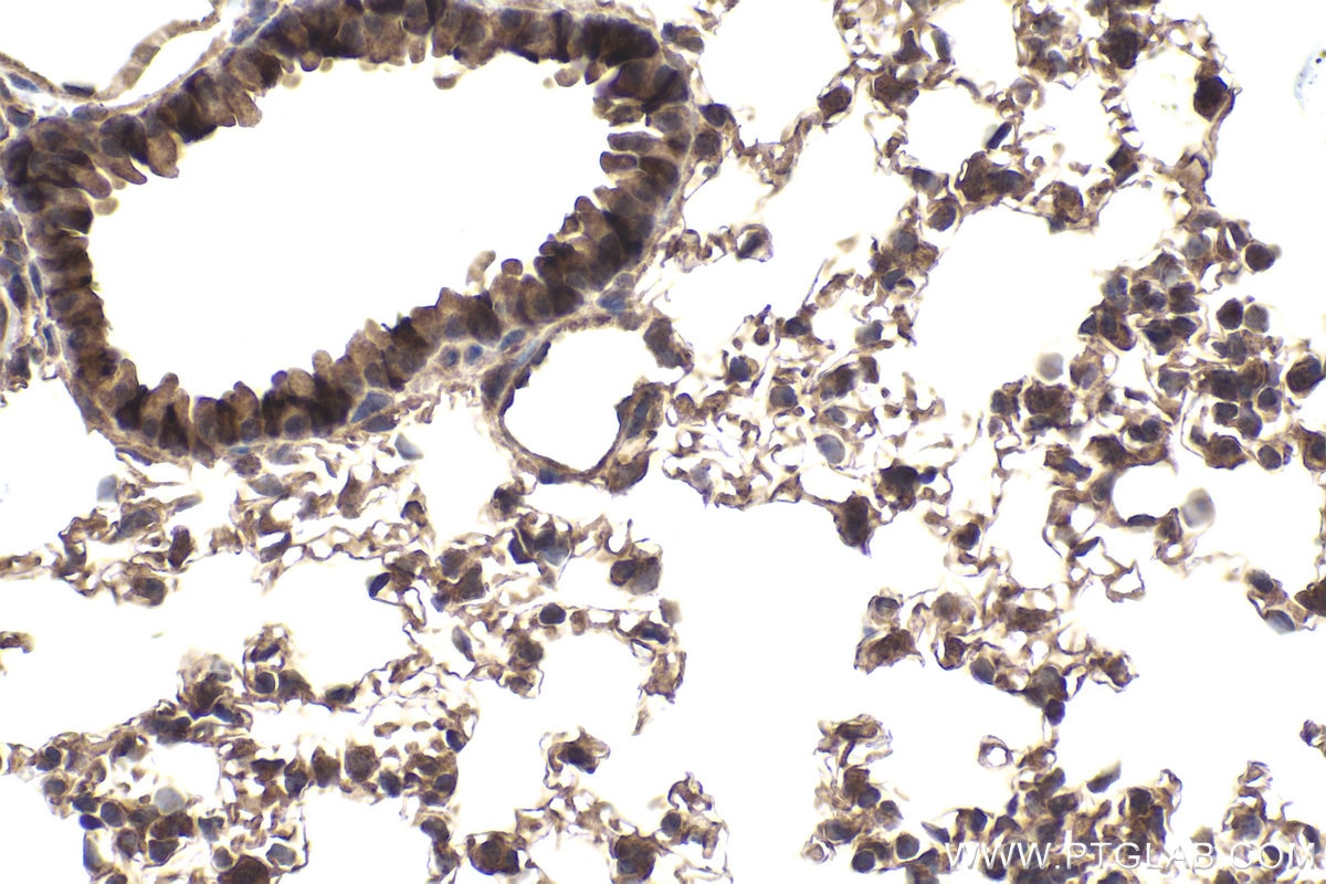 Immunohistochemical analysis of paraffin-embedded mouse lung tissue slide using KHC1956 (DCP1A IHC Kit).