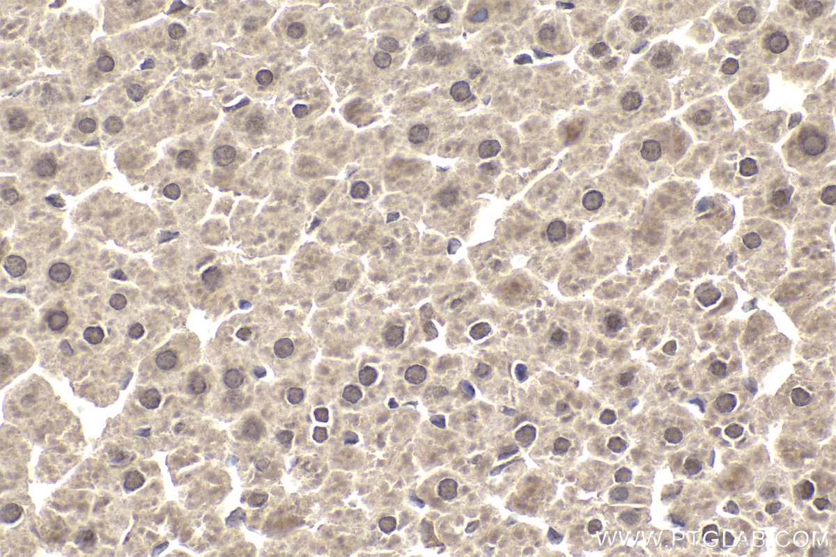 Immunohistochemical analysis of paraffin-embedded rat liver tissue slide using KHC1956 (DCP1A IHC Kit).