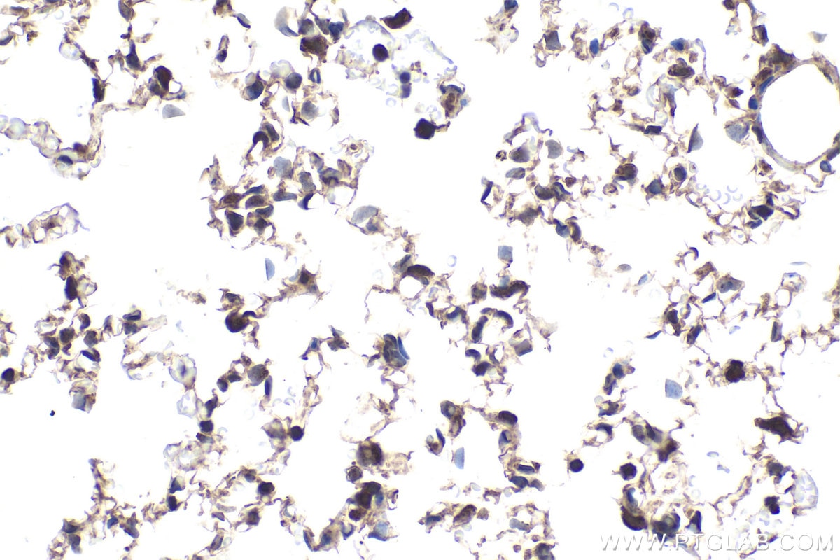 Immunohistochemical analysis of paraffin-embedded rat lung tissue slide using KHC1956 (DCP1A IHC Kit).