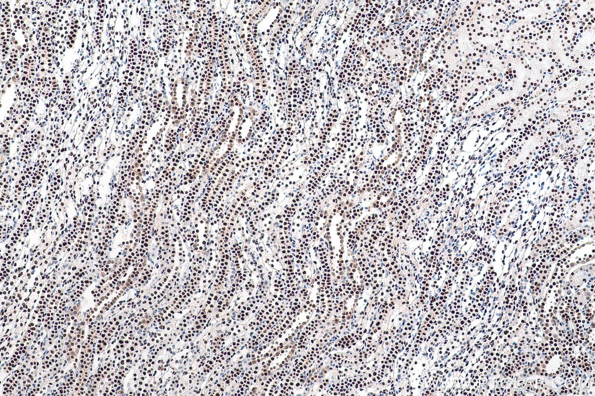 Immunohistochemical analysis of paraffin-embedded rat kidney tissue slide using KHC0923 (DCPS IHC Kit).
