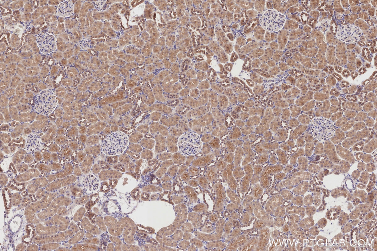 Immunohistochemical analysis of paraffin-embedded rat kidney tissue slide using KHC2866 (DCTN5 IHC Kit).