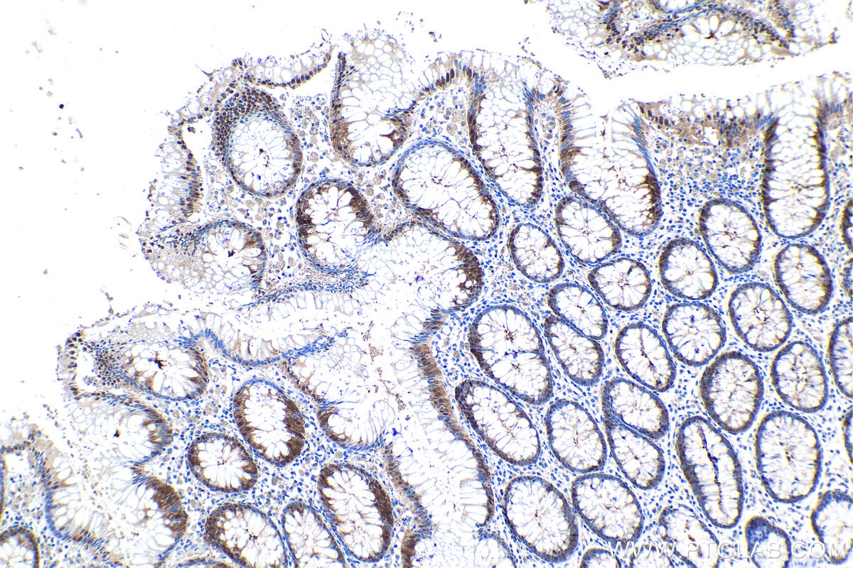 Immunohistochemical analysis of paraffin-embedded human colon tissue slide using KHC1183 (DCTPP1 IHC Kit).