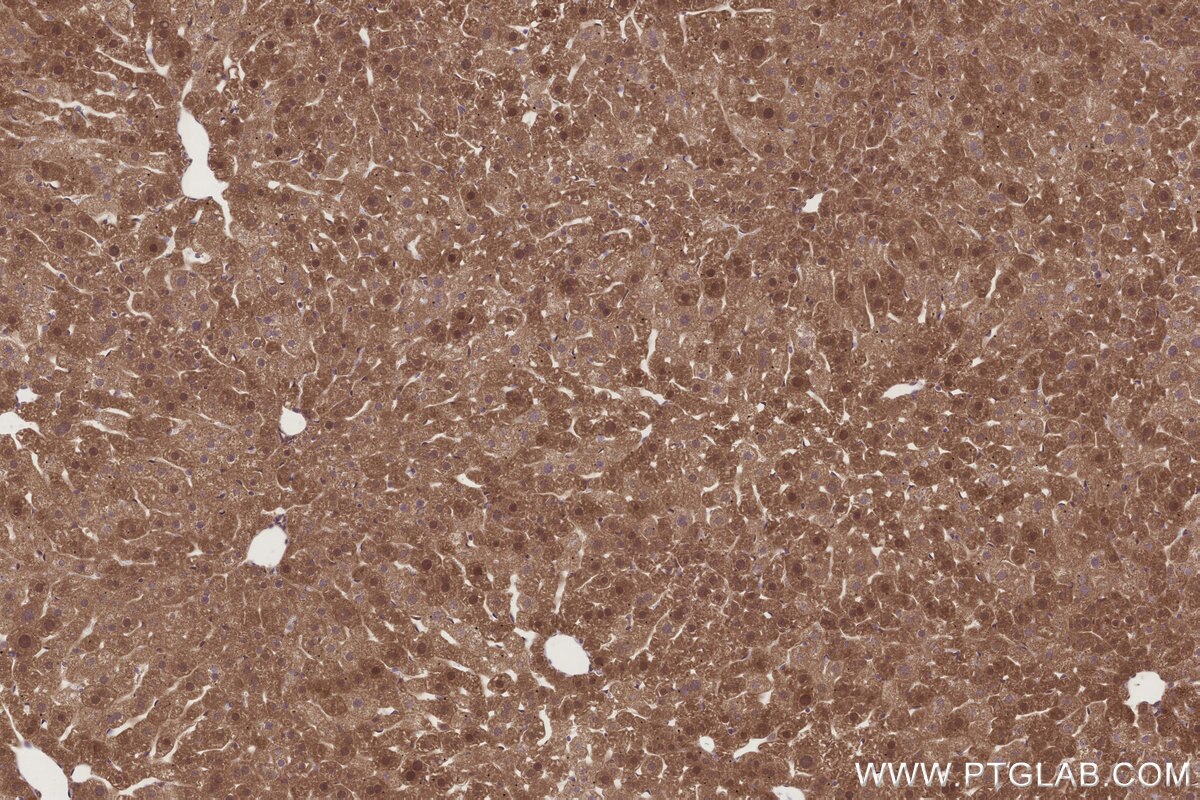 Immunohistochemical analysis of paraffin-embedded mouse liver tissue slide using KHC3272 (DCUN1D2 IHC Kit). Immunohistochemical analysis of paraffin-embedded mouse liver tissue slide using KHC3272 (DCUN1D2 IHC Kit).