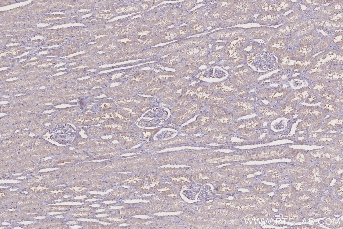 Immunohistochemical analysis of paraffin-embedded human kidney tissue slide using KHC3272 (DCUN1D2 IHC Kit). Immunohistochemical analysis of paraffin-embedded human kidney tissue slide using KHC3272 (DCUN1D2 IHC Kit).
