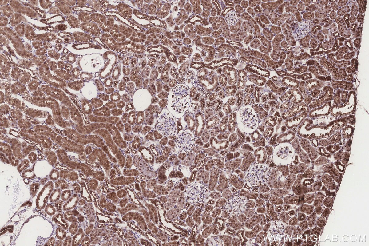 Immunohistochemical analysis of paraffin-embedded rat kidney tissue slide using KHC3272 (DCUN1D2 IHC Kit). Immunohistochemical analysis of paraffin-embedded rat kidney tissue slide using KHC3272 (DCUN1D2 IHC Kit).
