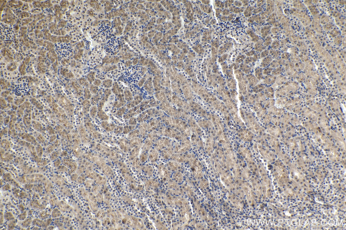 Immunohistochemical analysis of paraffin-embedded mouse kidney tissue slide using KHC1190 (DDA1 IHC Kit).