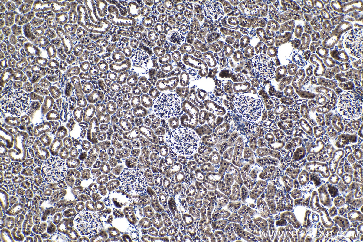 Immunohistochemical analysis of paraffin-embedded rat kidney tissue slide using KHC1190 (DDA1 IHC Kit).