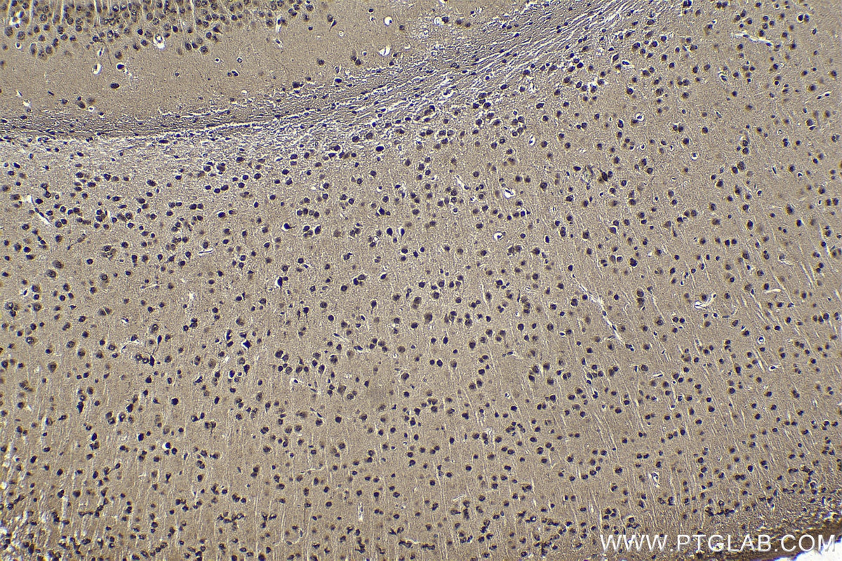Immunohistochemical analysis of paraffin-embedded mouse brain tissue slide using KHC1760 (DDB1 IHC Kit).
