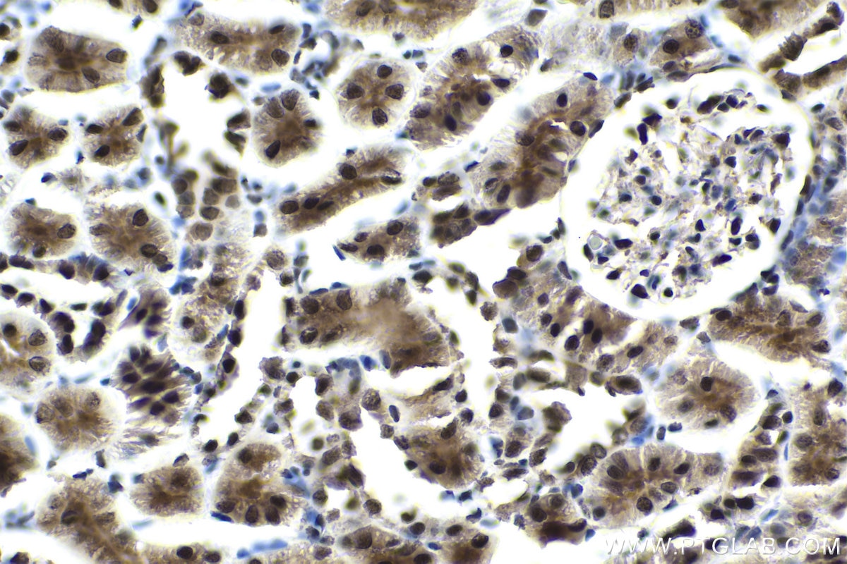 Immunohistochemical analysis of paraffin-embedded rat kidney tissue slide using KHC1760 (DDB1 IHC Kit).