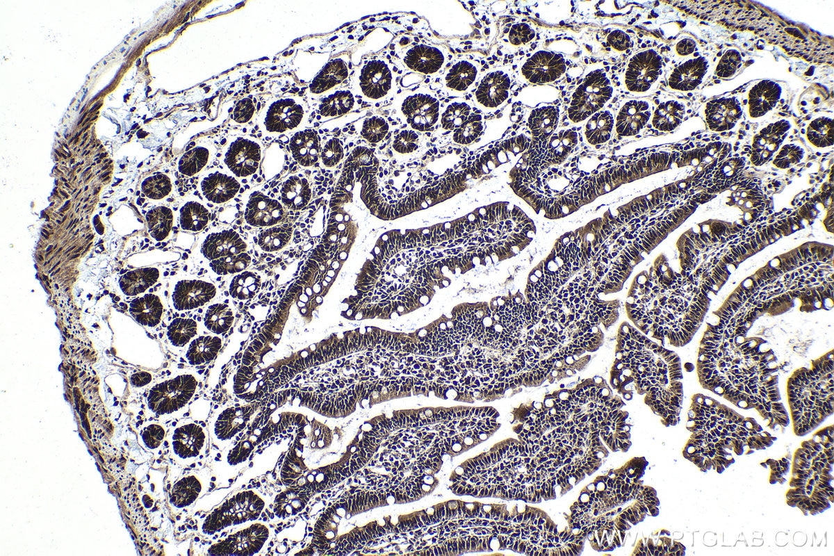 Immunohistochemical analysis of paraffin-embedded rat small intestine tissue slide using KHC1760 (DDB1 IHC Kit).